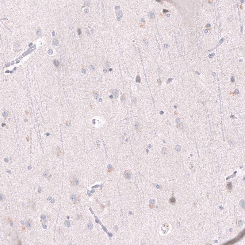 Immunohistochemistry-Paraffin: EZH2/KMT6 Antibody [NBP3-21204] -