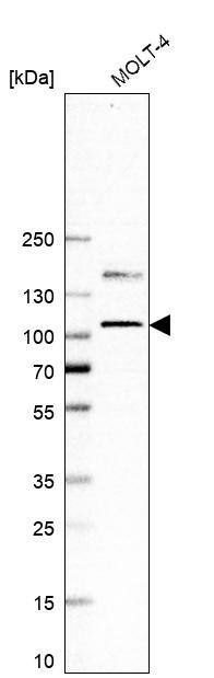 Western Blot: EZH2/KMT6 Antibody [NBP3-21204] -