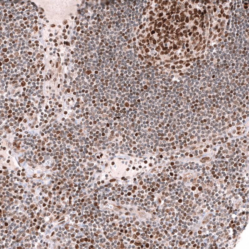 Immunohistochemistry-Paraffin: EZH2/KMT6 Antibody [NBP3-21204] -
