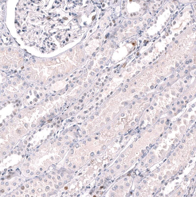 Immunohistochemistry-Paraffin: EZH2/KMT6 Antibody [NBP3-21204] -