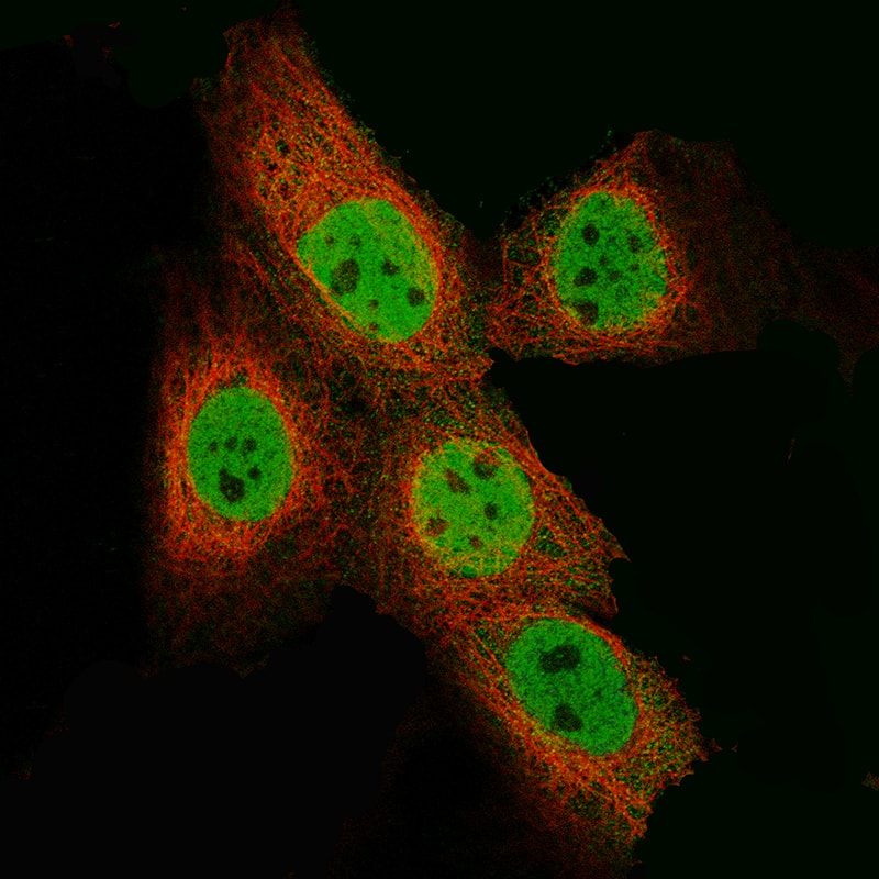 Immunocytochemistry/Immunofluorescence: EZH2/KMT6 Antibody [NBP3-21205] -