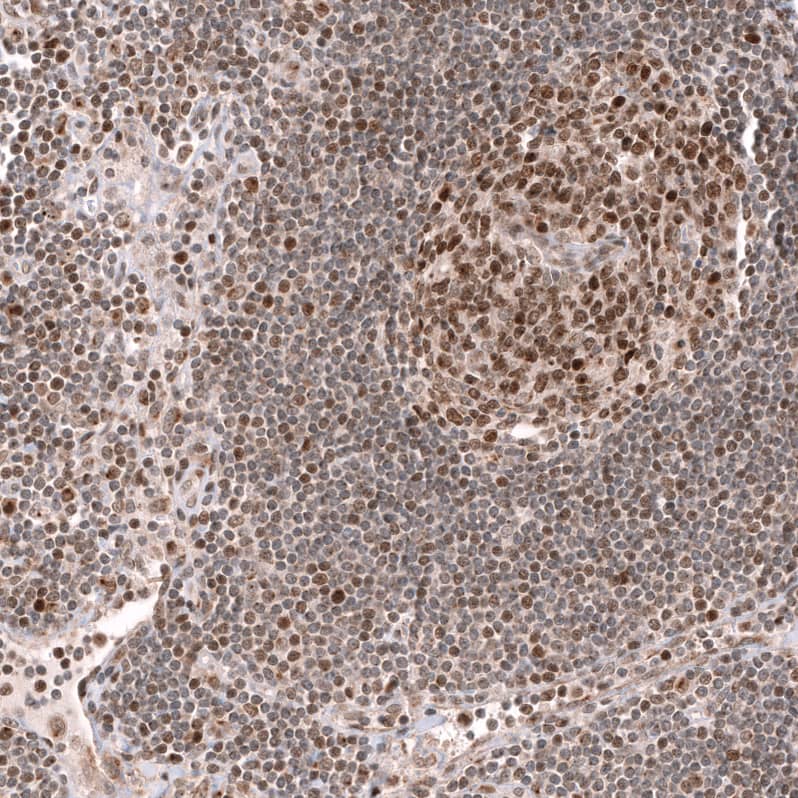 Immunohistochemistry-Paraffin: EZH2/KMT6 Antibody [NBP3-21205] -