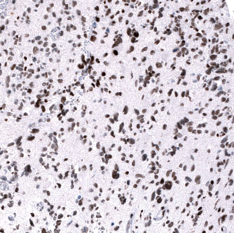 Immunohistochemistry-Paraffin: EZH2/KMT6 Antibody [NBP3-21205] -