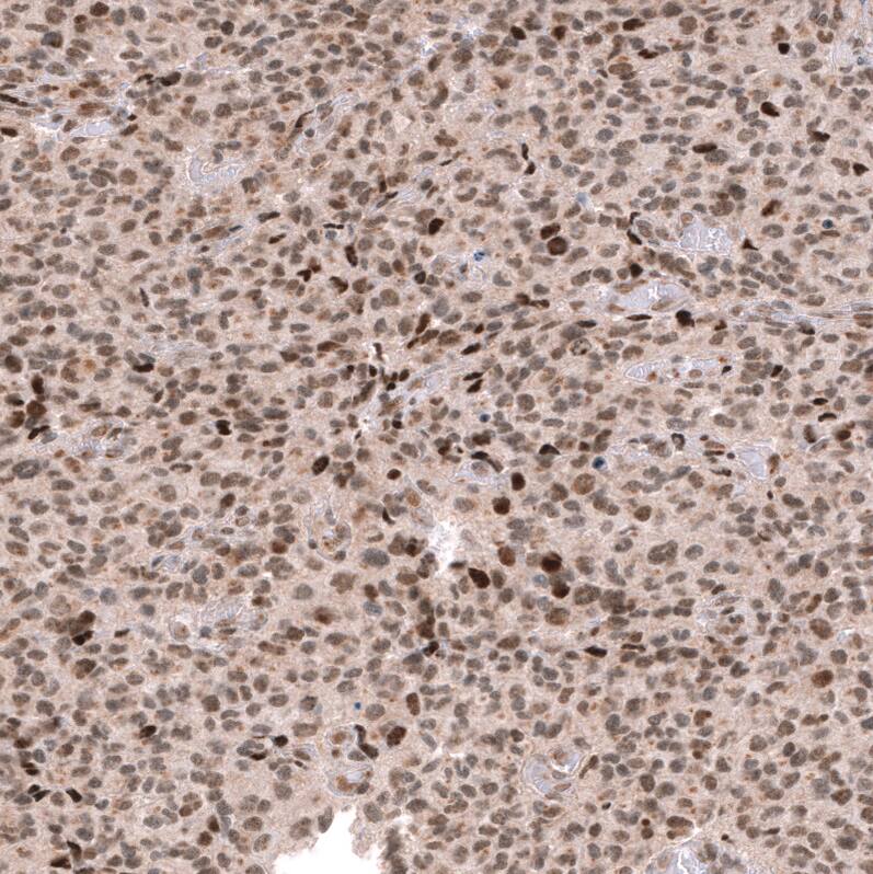 Immunohistochemistry-Paraffin: EZH2/KMT6 Antibody [NBP3-21205] -