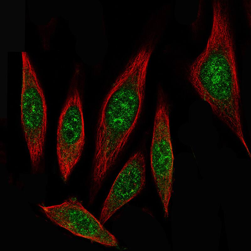 ID1 Antibody (CL11981) - BSA Free Immunocytochemistry/ Immunofluorescence: ID1 Antibody [NBP3-21206] -