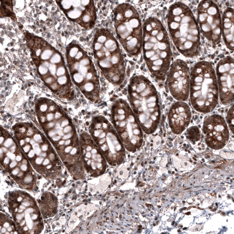 Immunohistochemistry-Paraffin: ID1 Antibody [NBP3-21206] -