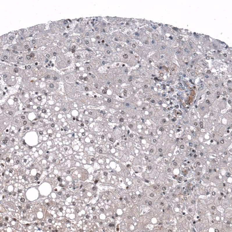 Immunohistochemistry-Paraffin: ID1 Antibody [NBP3-21206] -