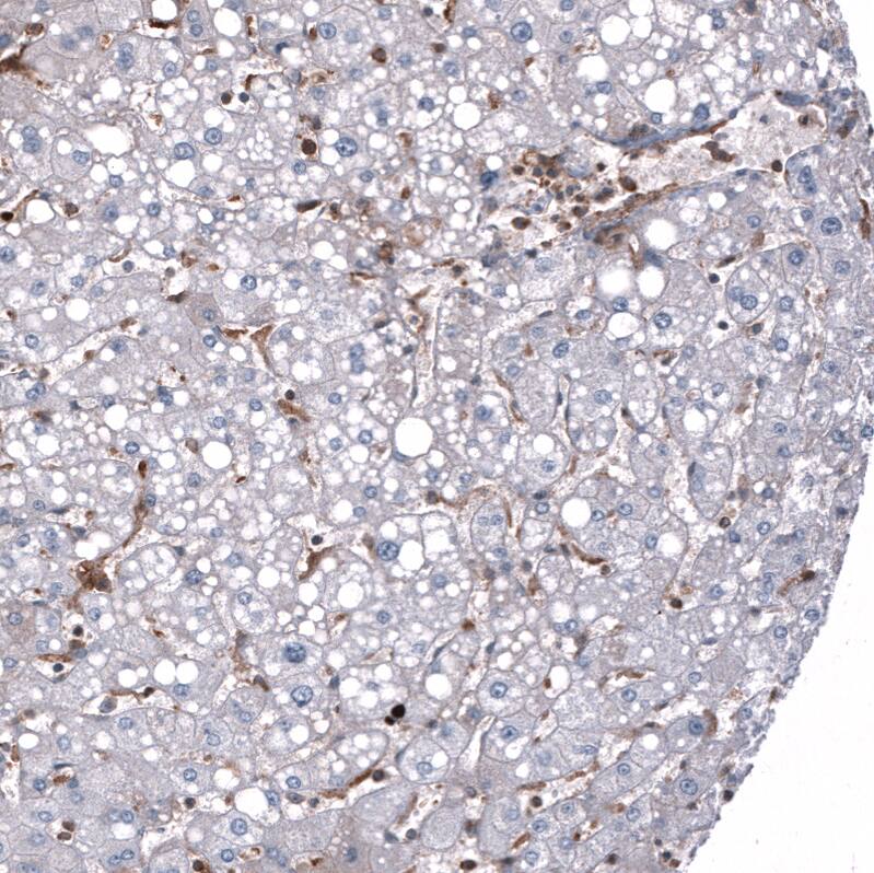 Immunohistochemistry-Paraffin: Periostin/OSF-2 Antibody [NBP3-21207] -