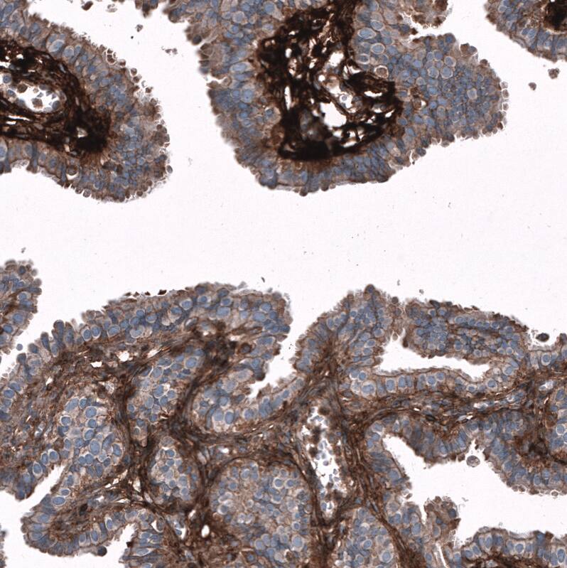 Immunohistochemistry-Paraffin: Periostin/OSF-2 Antibody [NBP3-21207] -
