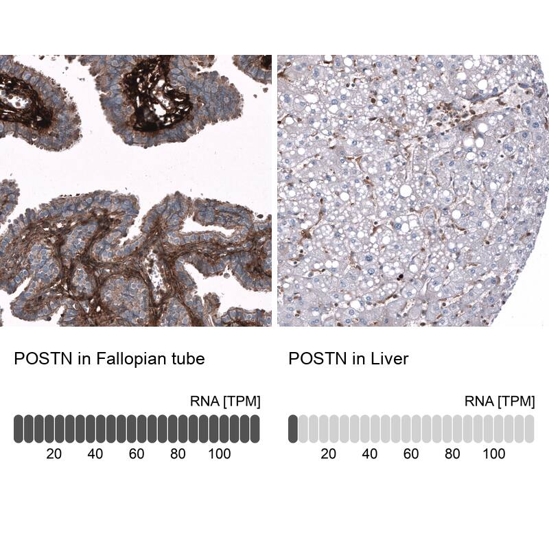 Immunohistochemistry-Paraffin: Periostin/OSF-2 Antibody [NBP3-21207] -