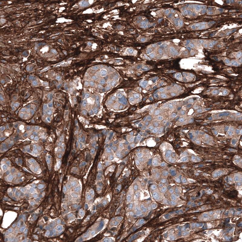 Immunohistochemistry-Paraffin: Periostin/OSF-2 Antibody [NBP3-21207] -