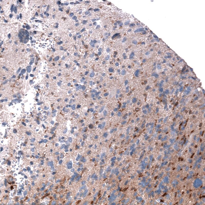 Immunohistochemistry-Paraffin: Periostin/OSF-2 Antibody [NBP3-21207] -
