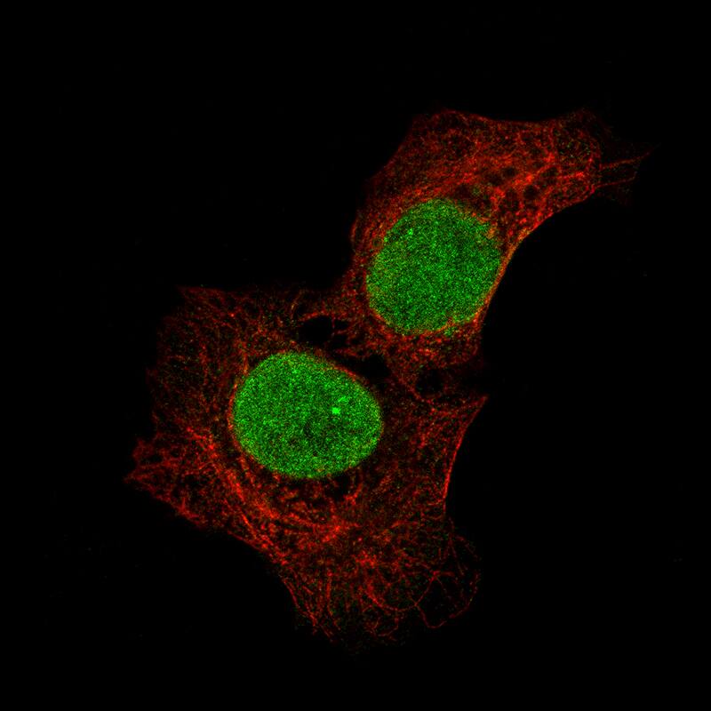 Immunocytochemistry/Immunofluorescence: SALL4 Antibody [NBP3-21208] -