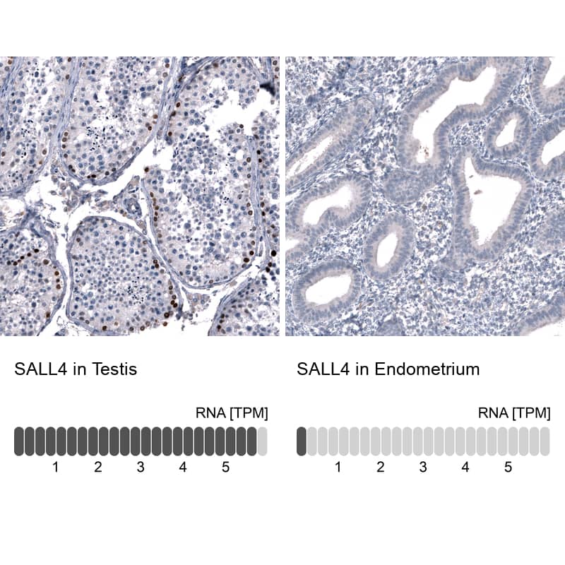 Immunohistochemistry-Paraffin: SALL4 Antibody [NBP3-21208] -