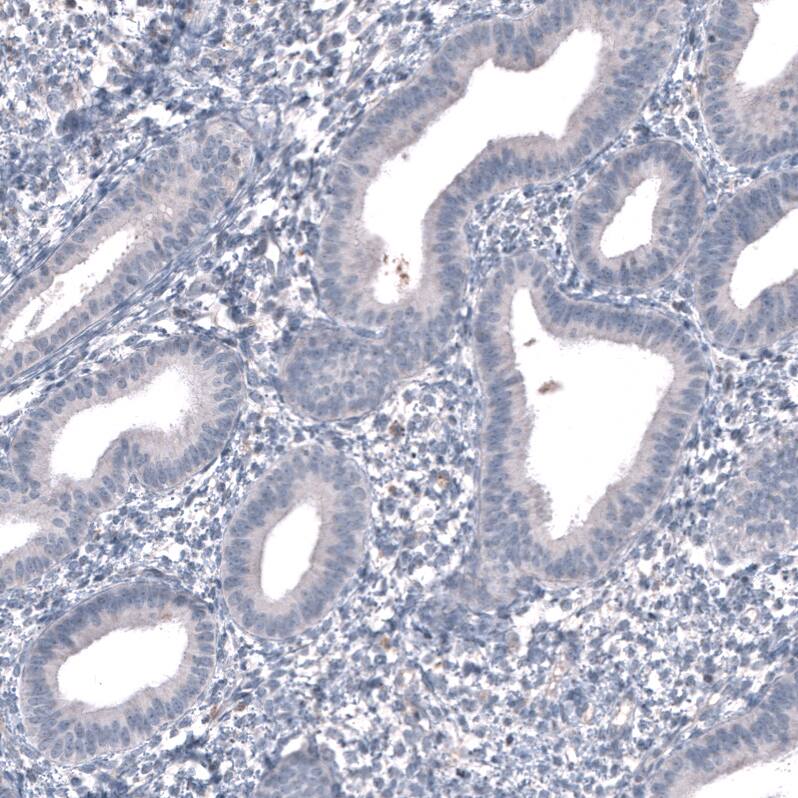Immunohistochemistry-Paraffin: SALL4 Antibody [NBP3-21208] -