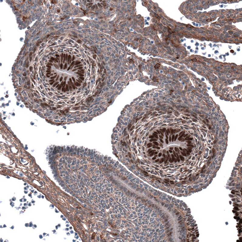 Immunohistochemistry-Paraffin: SALL4 Antibody [NBP3-21208] -
