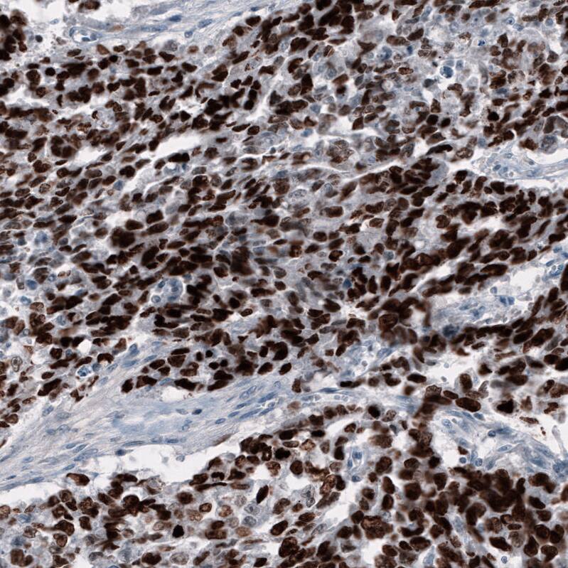 Immunohistochemistry-Paraffin: SALL4 Antibody [NBP3-21208] -