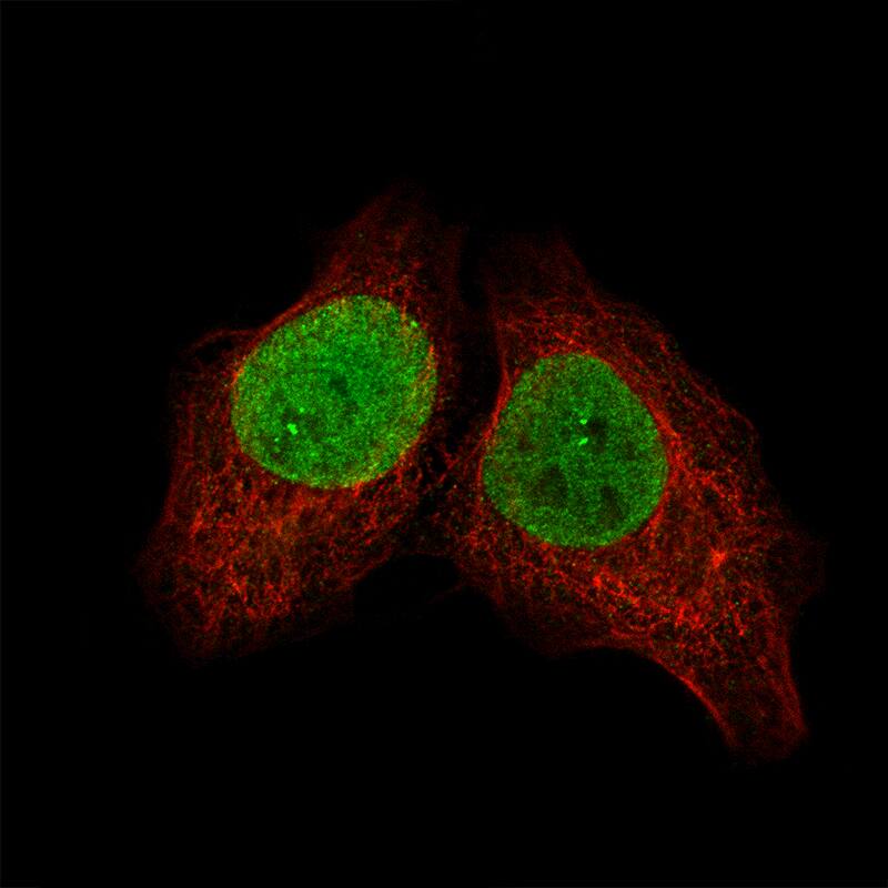 Immunocytochemistry/Immunofluorescence: SALL4 Antibody [NBP3-21209] -