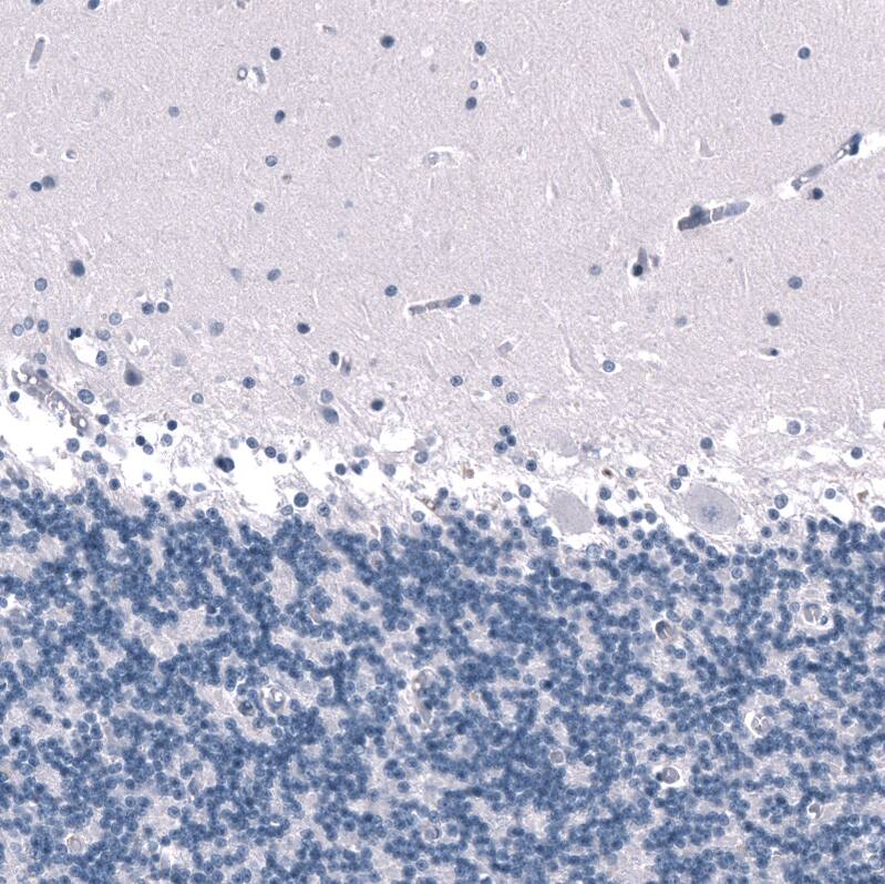 Immunohistochemistry-Paraffin: SALL4 Antibody [NBP3-21209] -