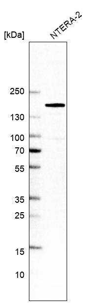 Western Blot: SALL4 Antibody [NBP3-21209] -