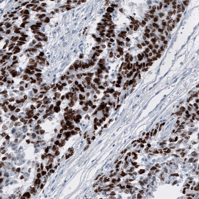 Immunohistochemistry-Paraffin: SALL4 Antibody [NBP3-21209] -