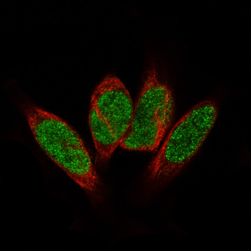 Immunocytochemistry/Immunofluorescence: GLI-1 Antibody [NBP3-21210] -