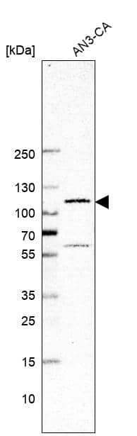 Western Blot: GLI-1 Antibody [NBP3-21210] -