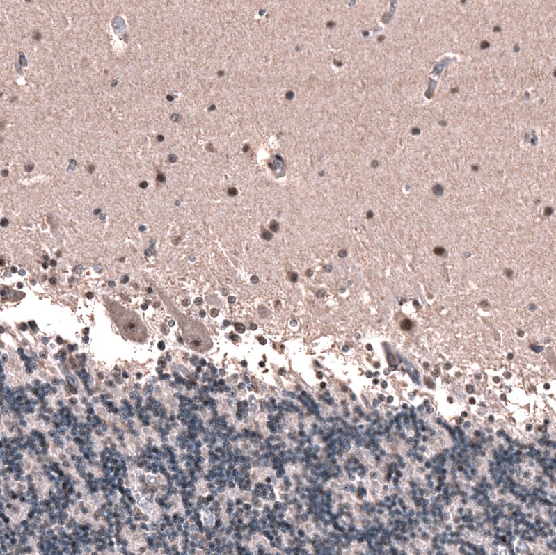 Immunohistochemistry-Paraffin: GLI-1 Antibody [NBP3-21211] -