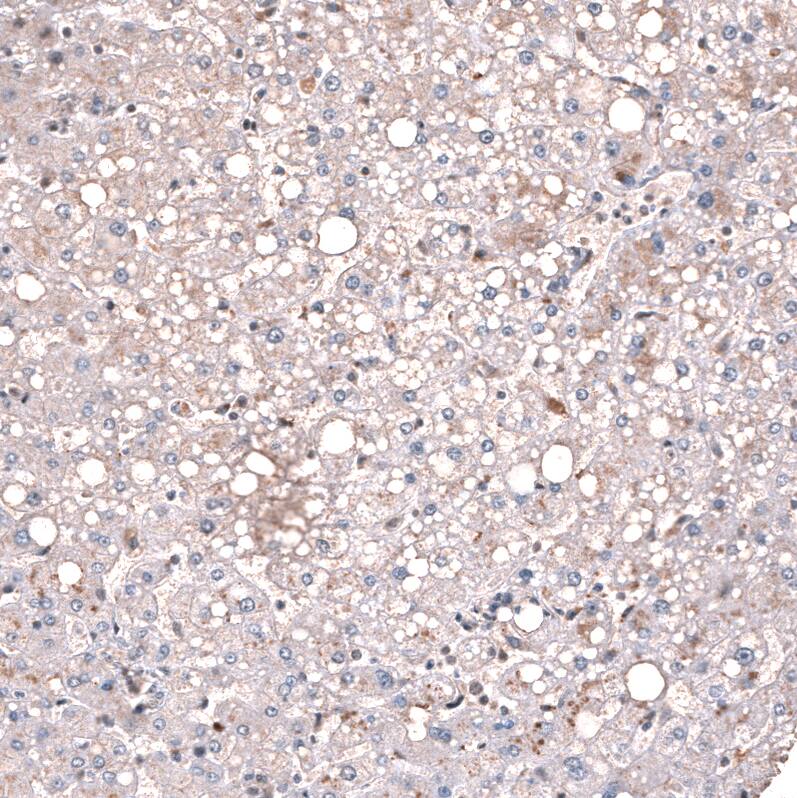 Immunohistochemistry-Paraffin: GLI-1 Antibody [NBP3-21211] -