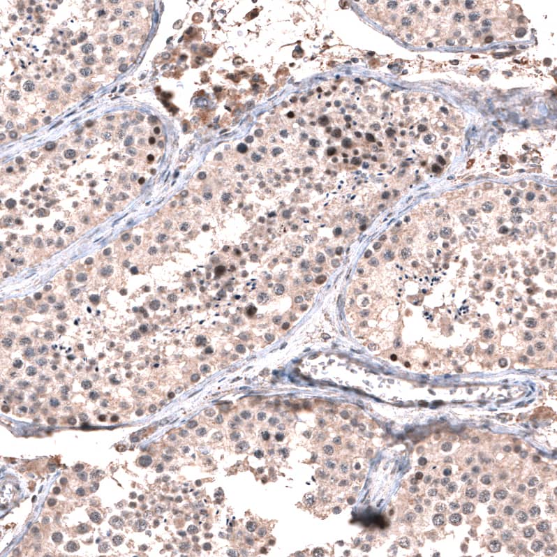 Immunohistochemistry-Paraffin: GLI-1 Antibody [NBP3-21211] -