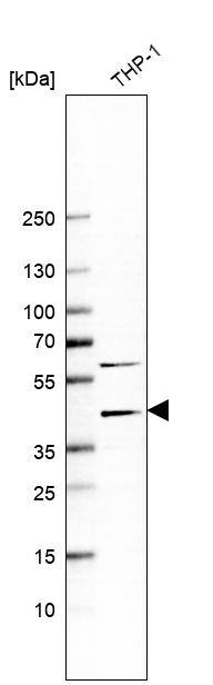 Western Blot: Chitinase 3-like 1 Antibody [NBP3-21212] -