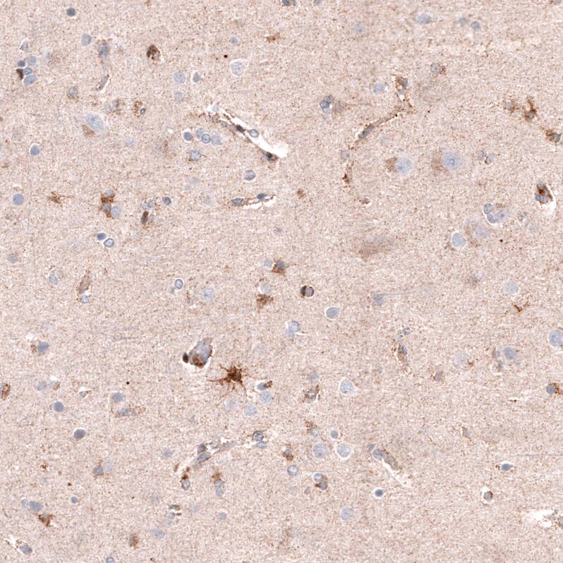 Immunohistochemistry-Paraffin: Chitinase 3-like 1 Antibody [NBP3-21212] -