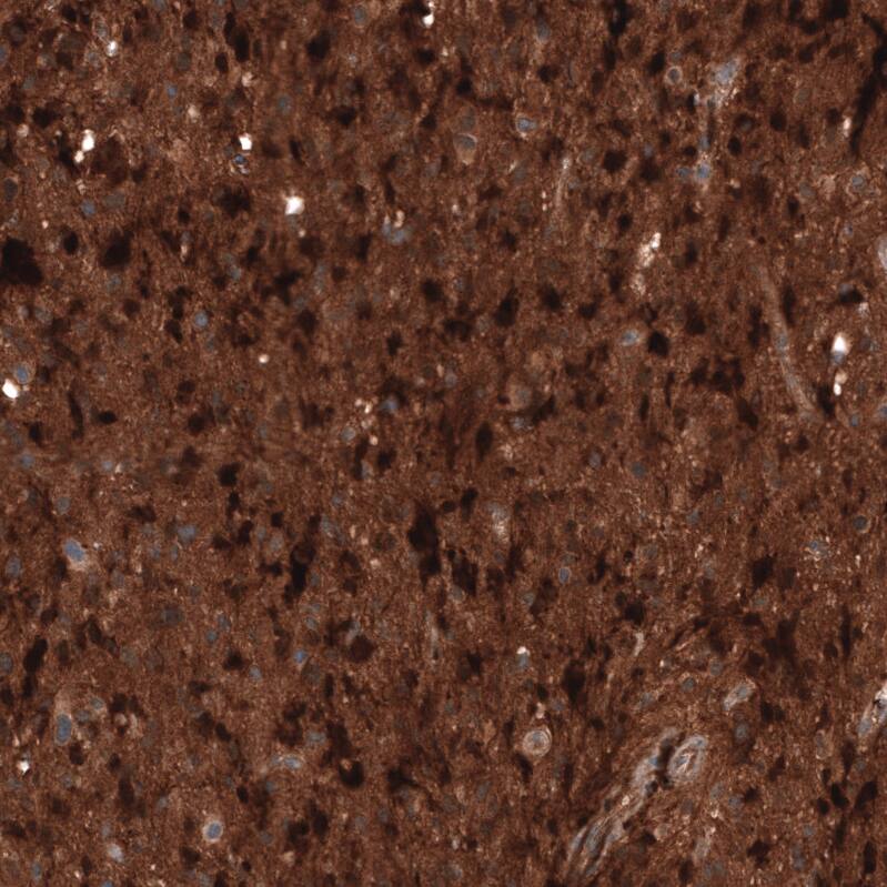 Immunohistochemistry-Paraffin: Chitinase 3-like 1 Antibody [NBP3-21212] -