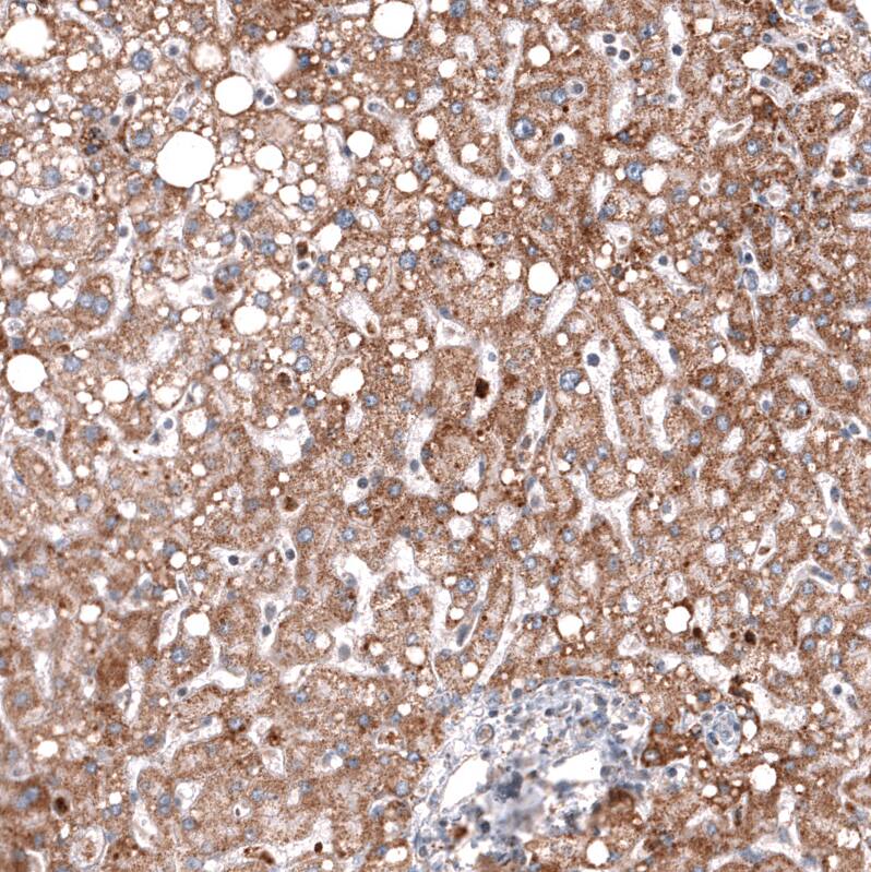 Immunohistochemistry-Paraffin: Chitinase 3-like 1 Antibody [NBP3-21212] -