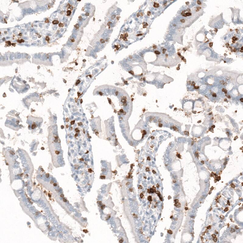 Immunohistochemistry-Paraffin: CD5 Antibody [NBP3-21215] -
