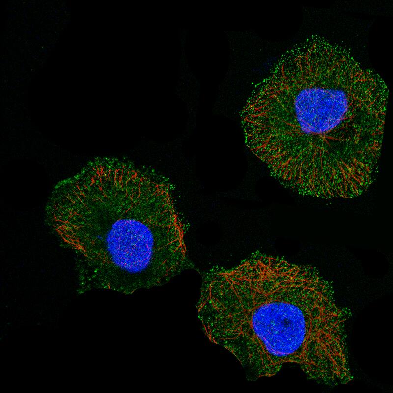 Immunocytochemistry/Immunofluorescence: CD5 Antibody [NBP3-21215] -