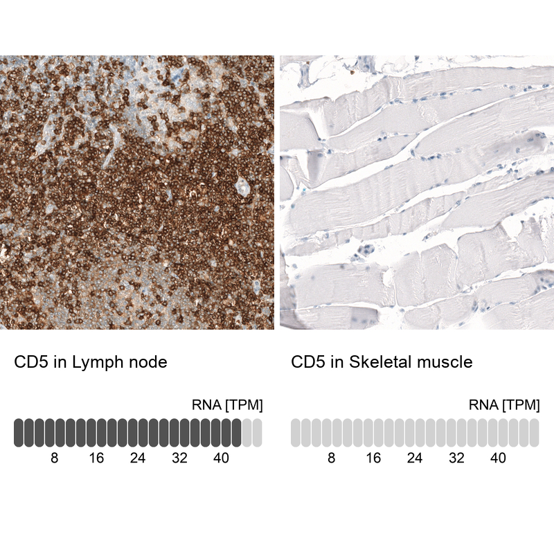 Immunohistochemistry-Paraffin: CD5 Antibody [NBP3-21215] -
