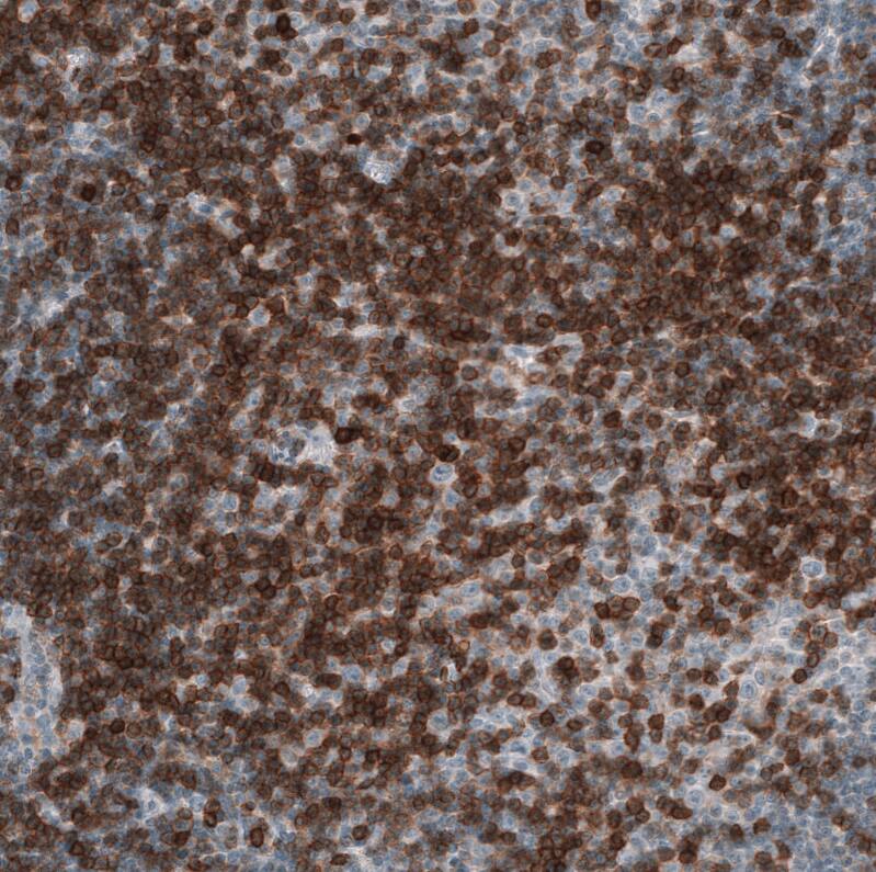 Immunohistochemistry-Paraffin: CD5 Antibody [NBP3-21215] -