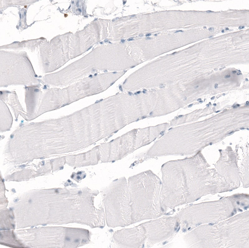 Immunohistochemistry-Paraffin: CD5 Antibody [NBP3-21215] -