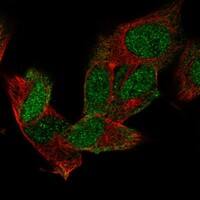 Immunocytochemistry/Immunofluorescence: Musashi-1 Antibody [NBP3-21216] -