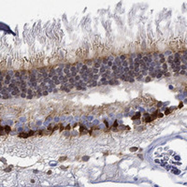 Immunohistochemistry-Paraffin: Musashi-1 Antibody [NBP3-21216] -