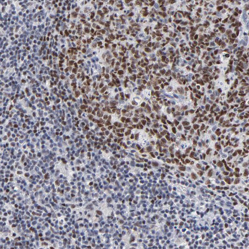 Immunohistochemistry-Paraffin: MBD4 Antibody [NBP3-21219] -