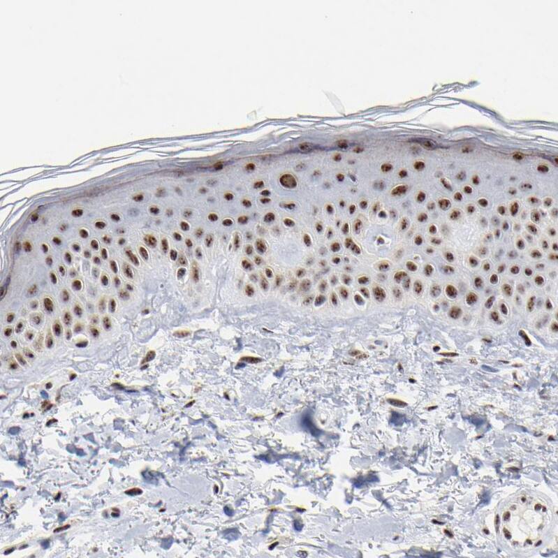 Immunohistochemistry-Paraffin: MBD4 Antibody [NBP3-21219] -
