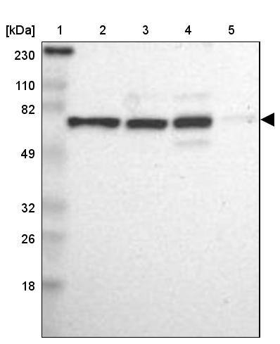 Western Blot: MBD4 Antibody [NBP3-21219] -