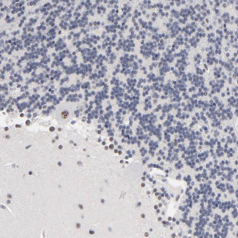 Immunohistochemistry-Paraffin: MBD4 Antibody [NBP3-21219] -