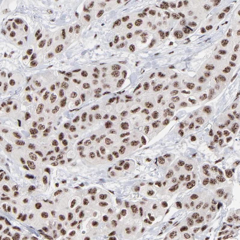 Immunohistochemistry-Paraffin: MBD4 Antibody [NBP3-21219] -