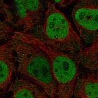 Immunocytochemistry/Immunofluorescence: Cdk7 Antibody [NBP3-21225] -