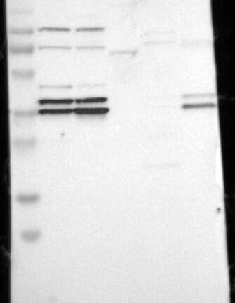 Western Blot: Cdk7 Antibody [NBP3-21225] -