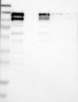 Western Blot: NEDD9/CASL/HEF1 Antibody [NBP3-21227] -