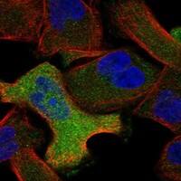 Immunocytochemistry/Immunofluorescence: Annexin A6 Antibody [NBP3-21228] -